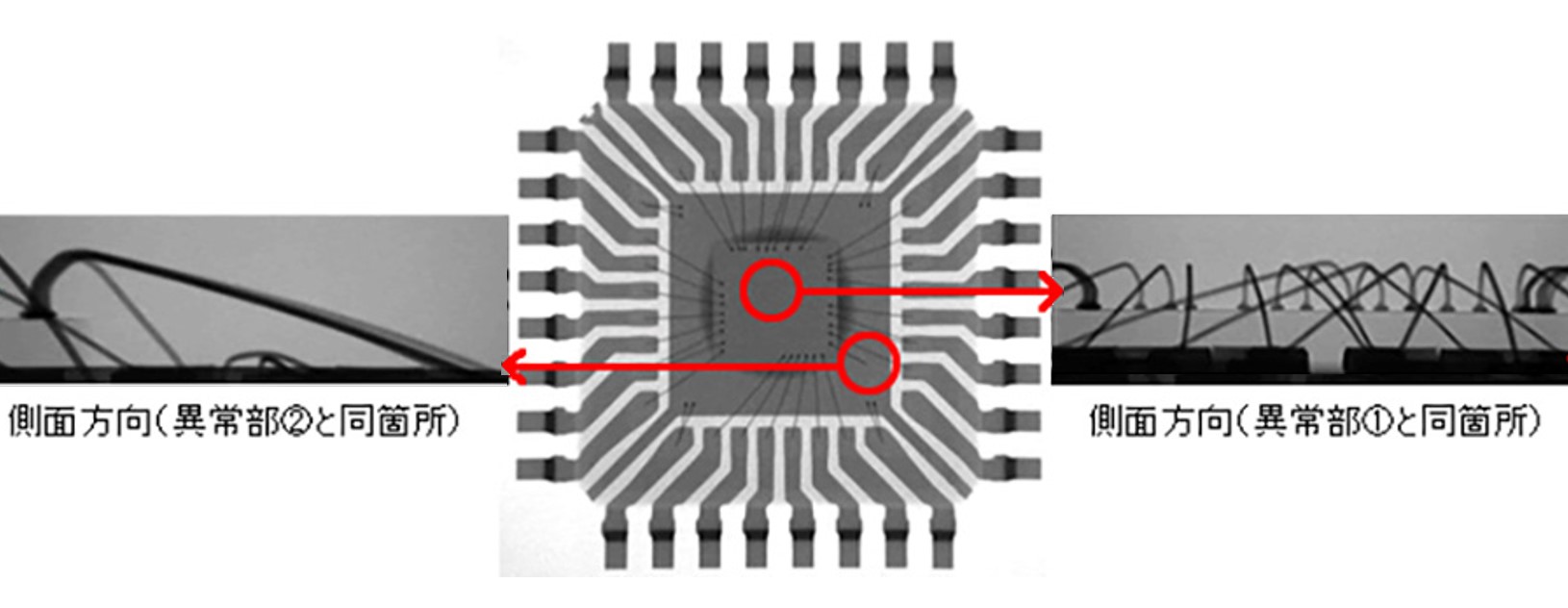 透過X線でのIC観察